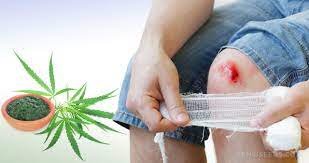 Can CBD Be Used to Heal Skin Injuries?